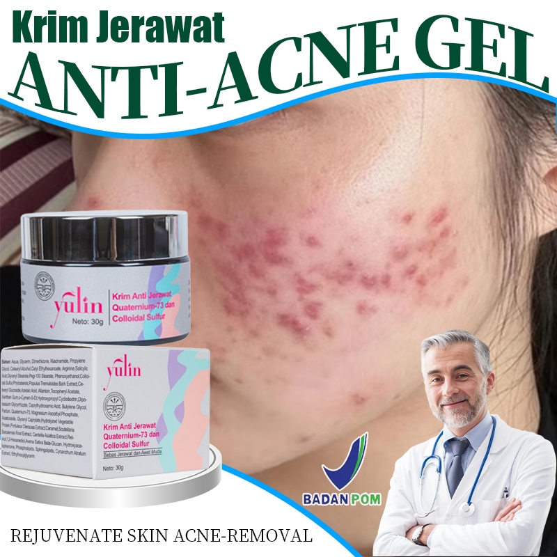YULIN Acne Spot Cream 30g | Salep Totol Jerawat Ampuh Atasi Jerawat, Beruntusan dan Memudarkan Bekas