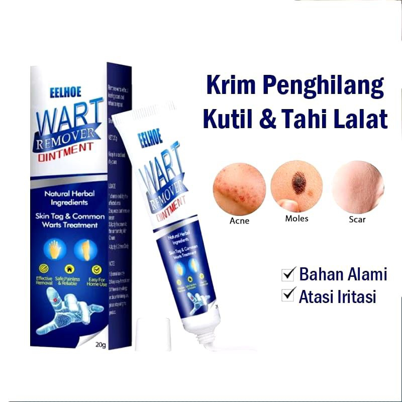 WART REMOVER OINTMENT SKINTAG REMOVER PENGHILANG TAHI LALAT