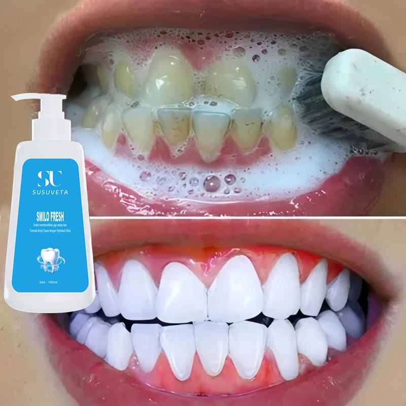 【BPOM】Pemutih gigi pembersih gigi kuning dan karang odol pemutih gigi dan karang gigi 100g perontok 