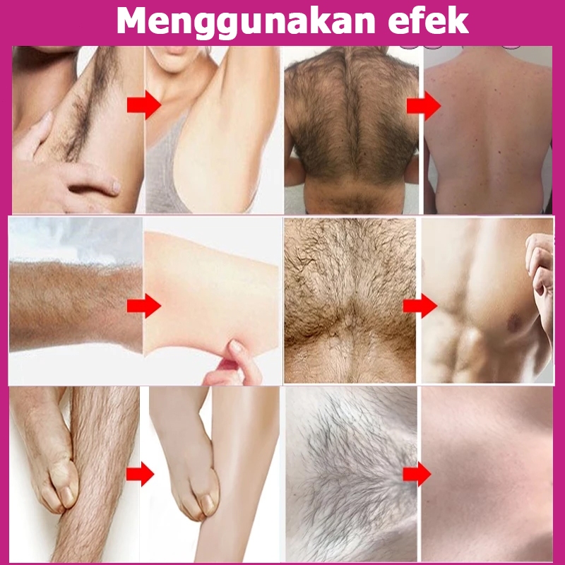 ADY78 Perontok bulu miss v permanen bpom perontok bulu kemaluan permanen pembersih bulu ketiak dan