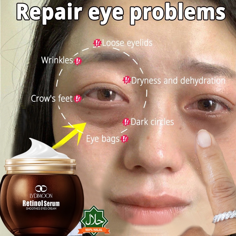 LYDIMOON Retinol Eye Cream penghilang kantung mata 35g cream mata panda dan kerutan/mengencang area 
