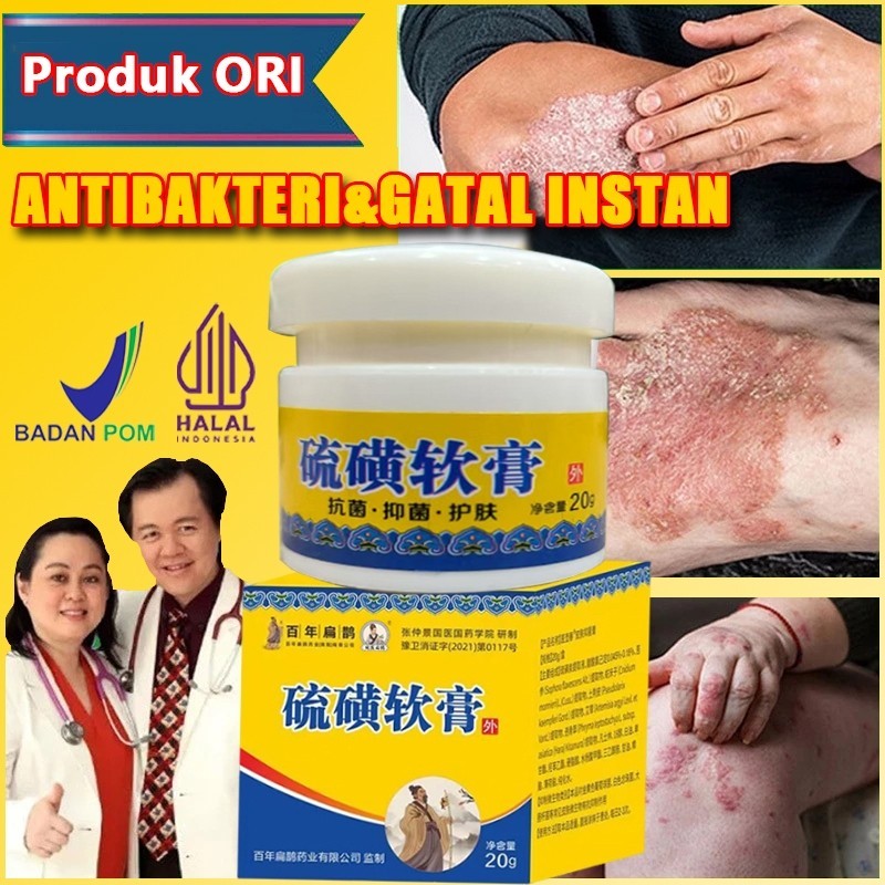 Salep Pereda Gatal Paling Ampuh Atasi Psoriasis, Eksim / Salep Gatal Paling Ampuh untuk Penyakit Kul