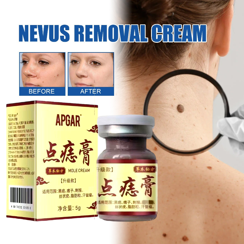 Efek bagus Obat Kutil paling ampuh Oles Penghilang Kutil manjur tanpa operasi mahal penghapus mengha