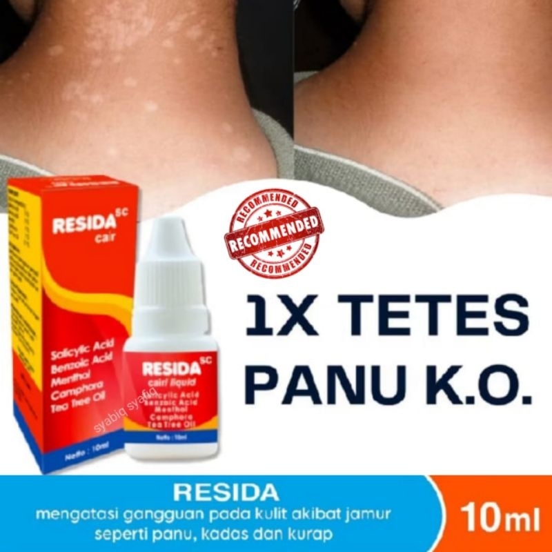 RESIDA SC Cair Obat panu kadas kurap paling ampuh original