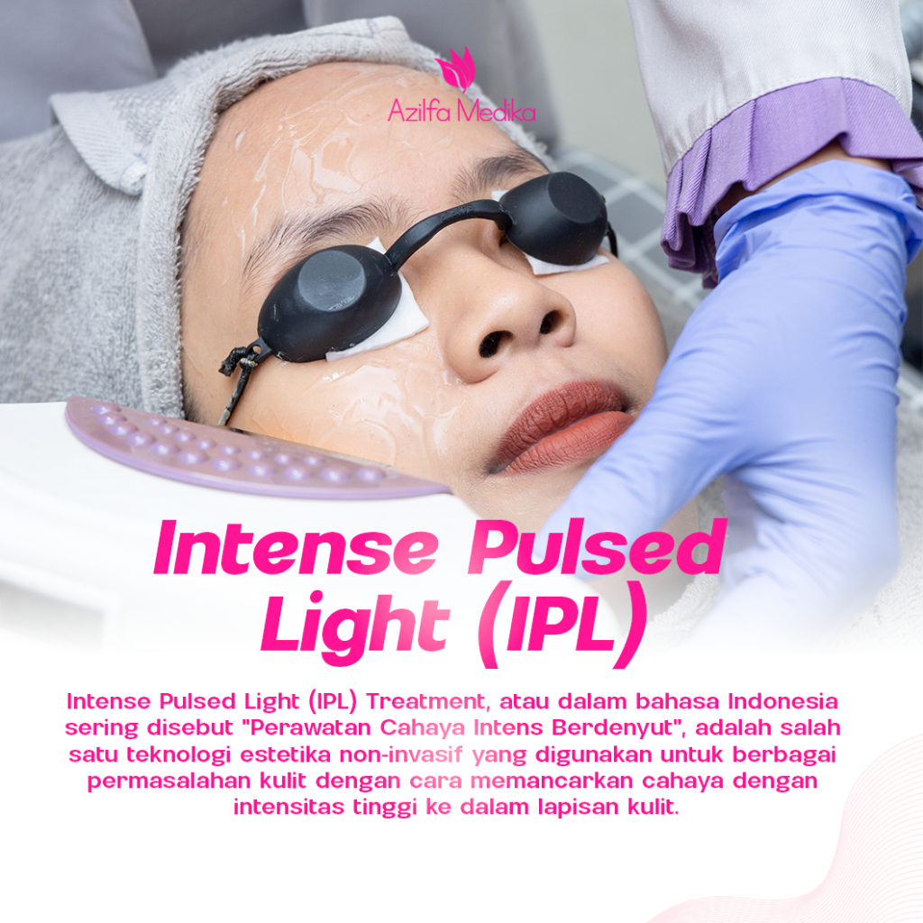 Treatment IPL (Intense Pluse Light) Voucher Treatment Azilfa Medika