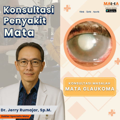 Konsultasi Penyakit Mata Glaukoma
