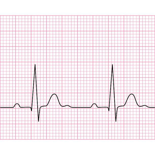 Kertas ECG Roll - ECG Paper / Kertas ECG Bionet
