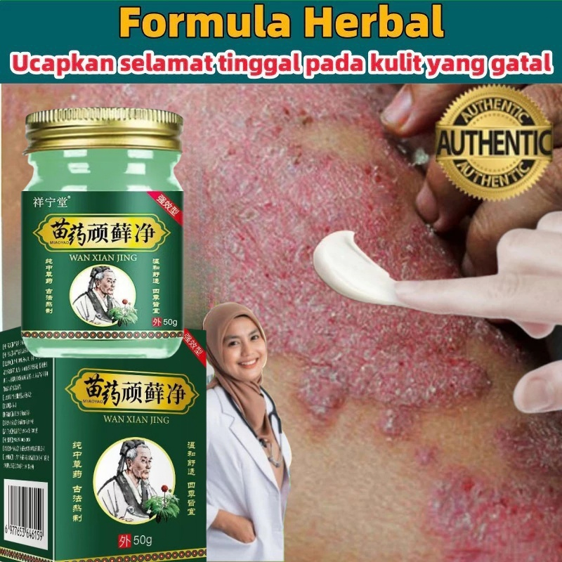 Cream Psoriasis Super Potent 100% Original 50g psoriasis obat gatal salep Gatal Salep gatal Salep ps