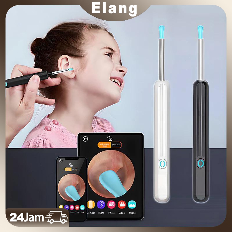 Pembersih telinga bayi korek kuping LED bayi pembersih kuping smart kamera WiFi hp korek kuping