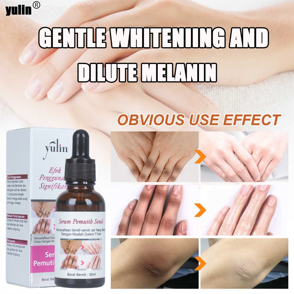 Yulin lightening serum pencerah lipatan whitening pemutih ketiak selangkangan lutut dan siku-pemutih
