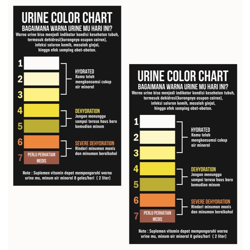 

Stiker Indikator Warna Urine Stiker Cek Warna Urine Stiker Cek Air Seni Stiker Indikasi