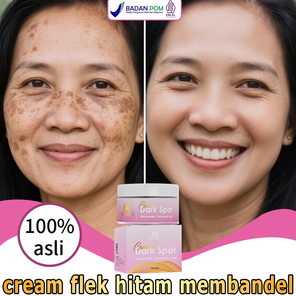 Salep flek hitam membandel menghilangkan flek hitam di wajah krim pemutih wajah bpom 30g