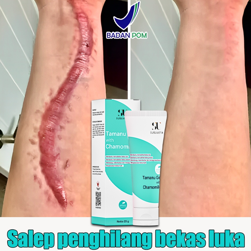 Cream penghilang bekas luka koreng Salep penghilang bekas luka Salep bekas luka koreng hitam 20g Oba