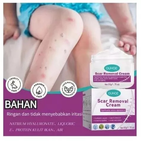SCAR REMOVAL CREAM PENGHILANG BEKAS LUKA GATAL BEKAS LUKA OPERASI