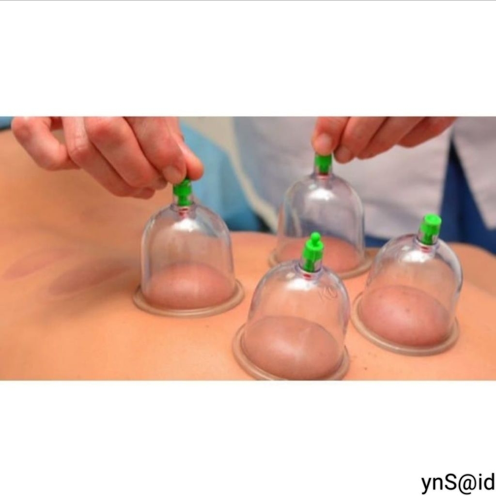 KOP ANGIN alat BEKAM 12 Kop