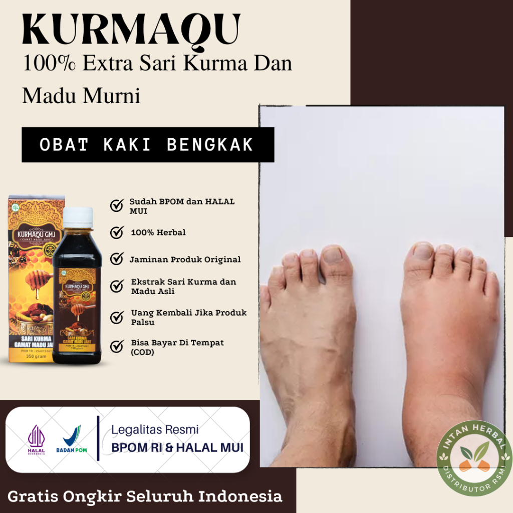 Kurmaqu - Obat Kaki Bengkak, Kaki Bengkak Karena Diabetes, Asam Urat, Jantung & Ginjal, Jempol Kaki 