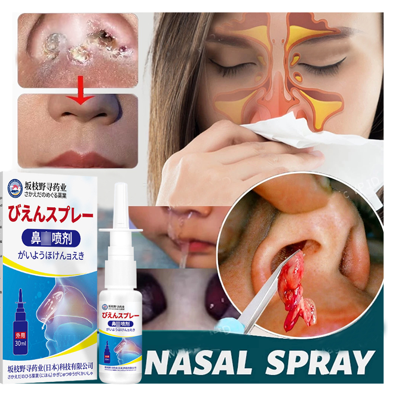 Nasal spray Obat sinusitis paling ampuh Nose Spray 30ml Obat Obat Polip Hidung Sinusitis / Obat Poli