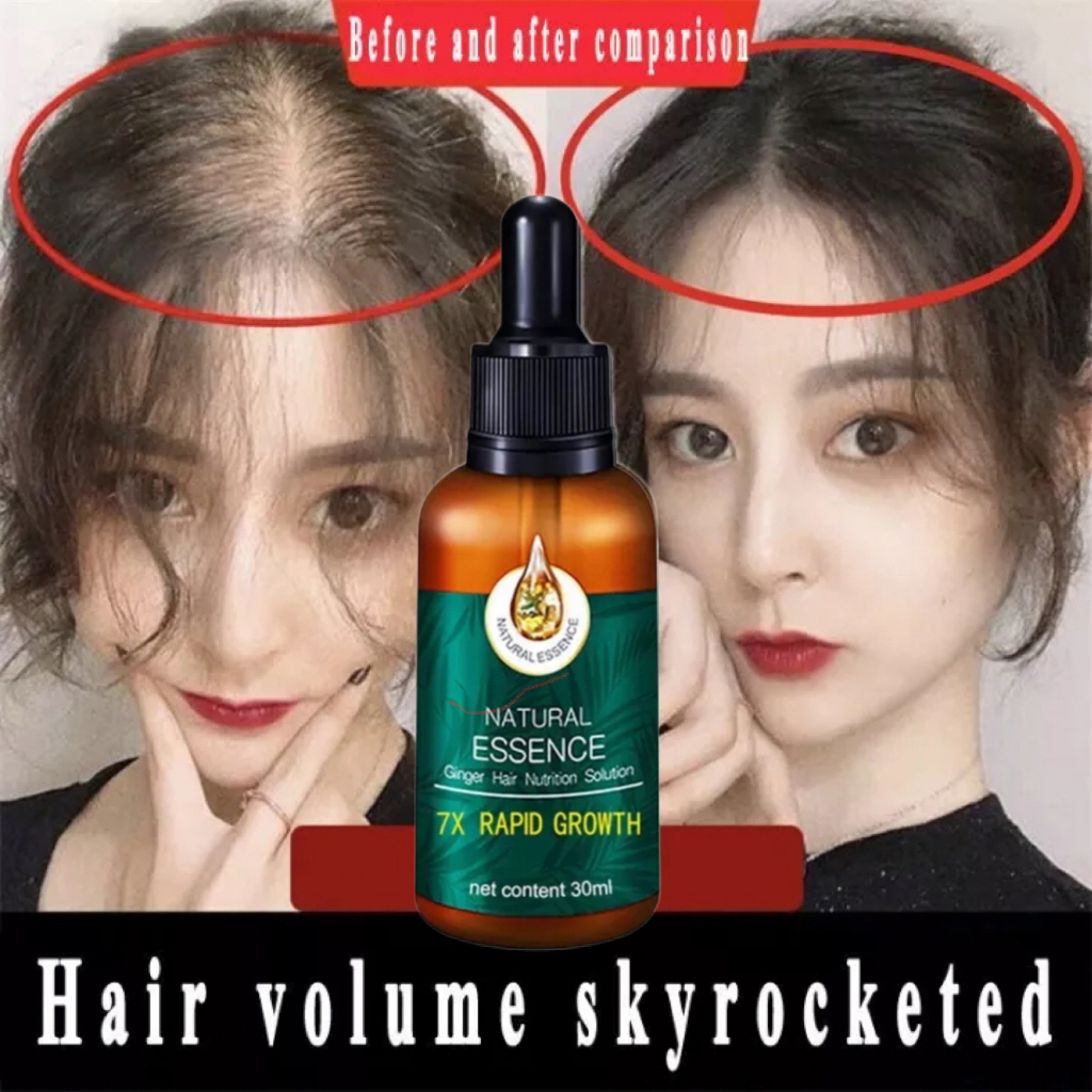 EELHOE Hair Growth Serum PENUMBUH RAMBUT Cairan Serum Penumbuh Rambut Anti Rontok /Obat Rambut Botak