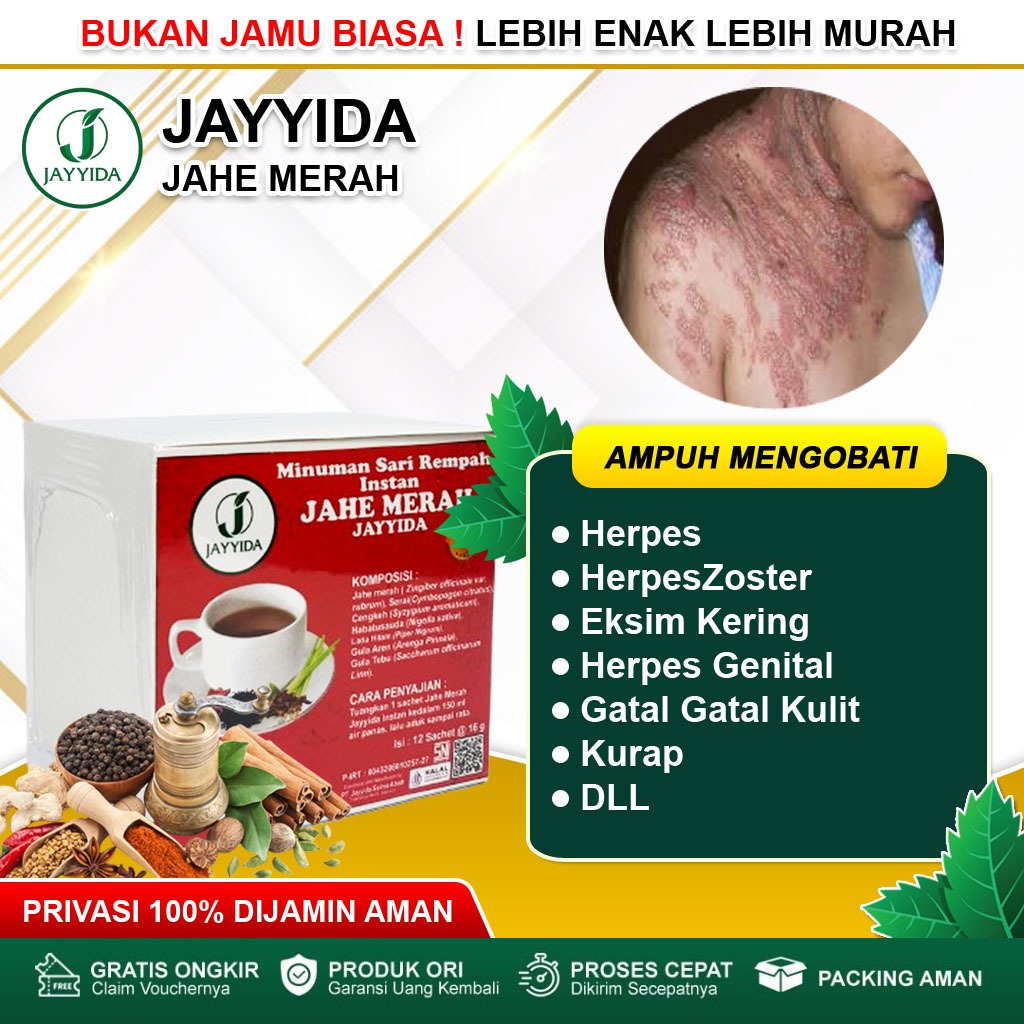 Obat Herpes, Herpes Kelamin, Herpes Kulit, Herpes Zoster, Alergi Kulit, Bintik Merah, Herpes Ginital
