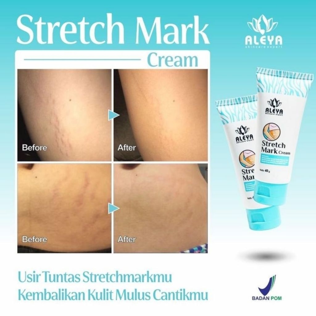 ALEYA stretch mark cream BPOM halal 40gr
