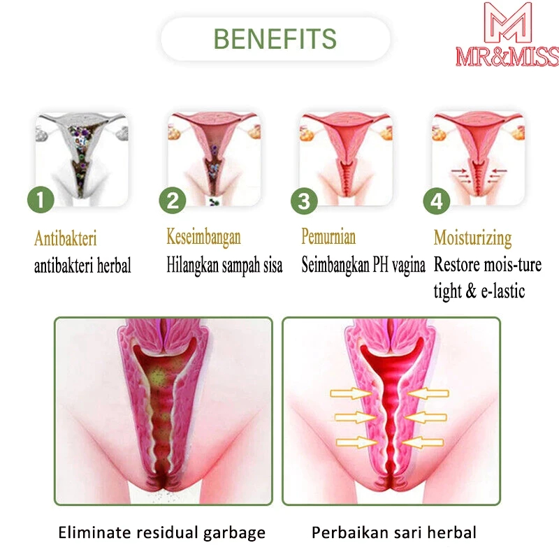 Hanovershop Rapet Miss V Kembali Perawan Miss V Rapet Dan Wangi Bpom Perapat Miss V Ampuh Bpom 30Ml