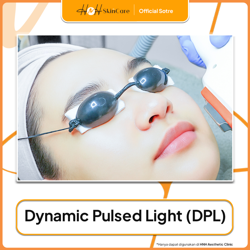 HNH DPL Treatment (Acne, Hair Removal, Skin Rejuv, Spot Melasma, Telengiektasis)