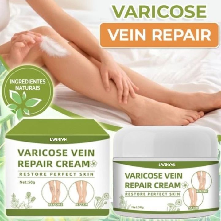 Krim Penghilang Varises Liwenyan Varicose Veins Cream