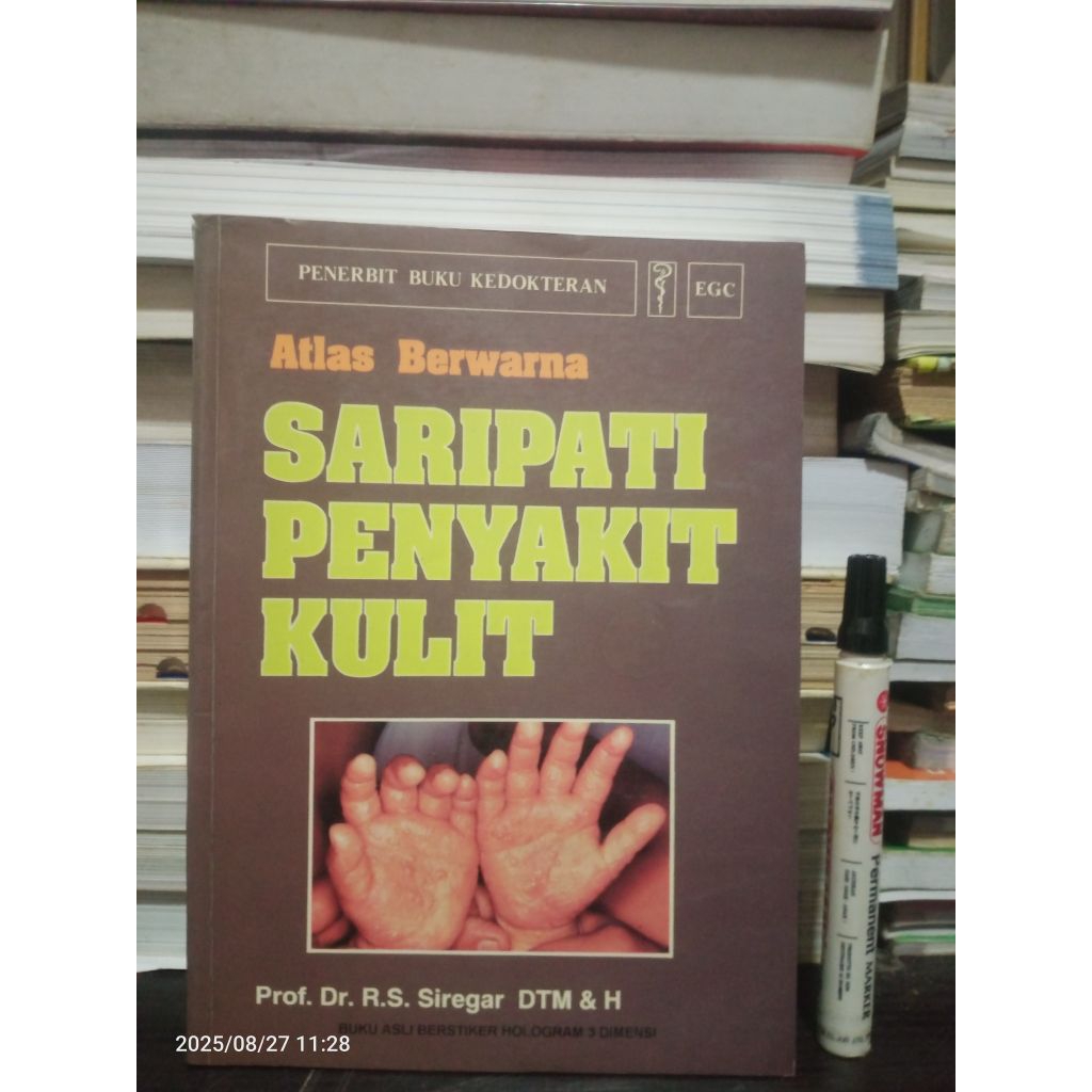 Buku Kedokteran: Saripati Penyakit Kulit, Atlas Berwarna