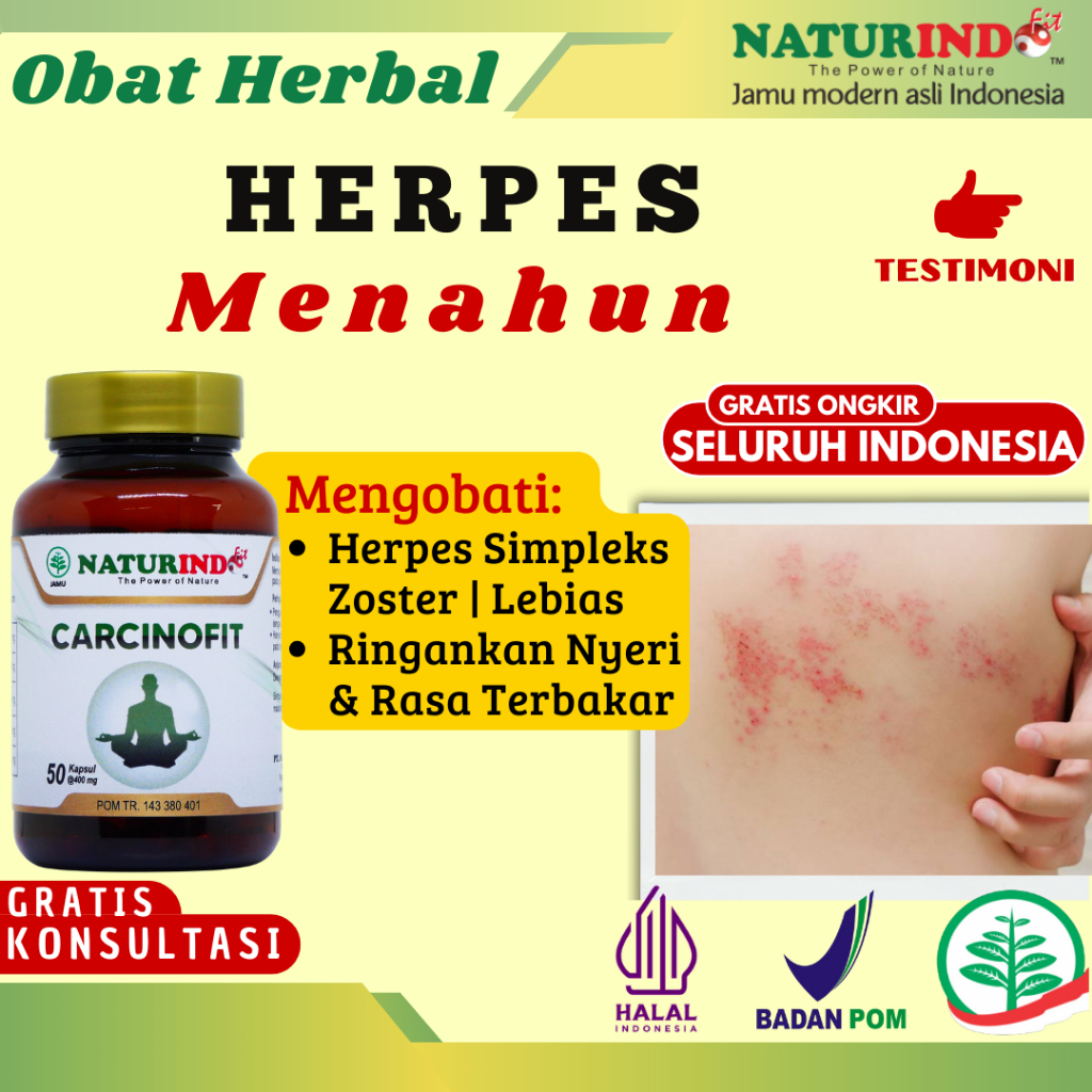 Obat Herpes Lepuh Ruam Cacar Air Kulit Bernanah Paling Ampuh Herbal NATURINDO CARCINOFIT BPOM COD