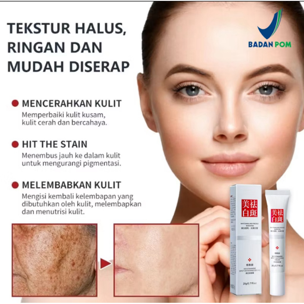 Fuyan Whitening Freckle Cream Remove Dark Spots Original