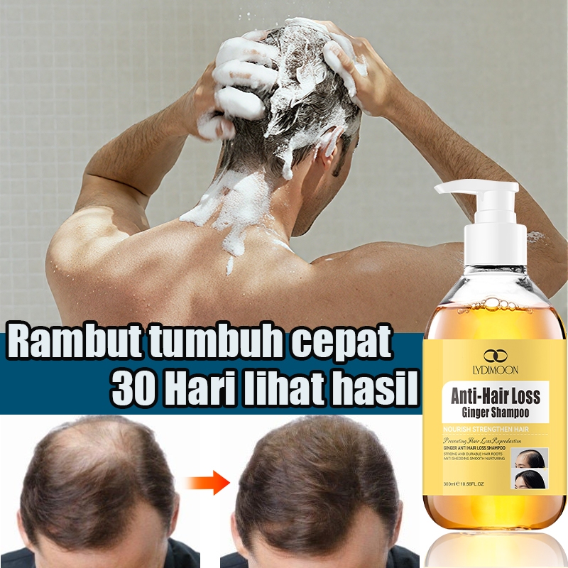 shampoo penumbuh rambut shampoo rambut rontok pria 300ml mengurangi rambut rontok rambut rontok dan 
