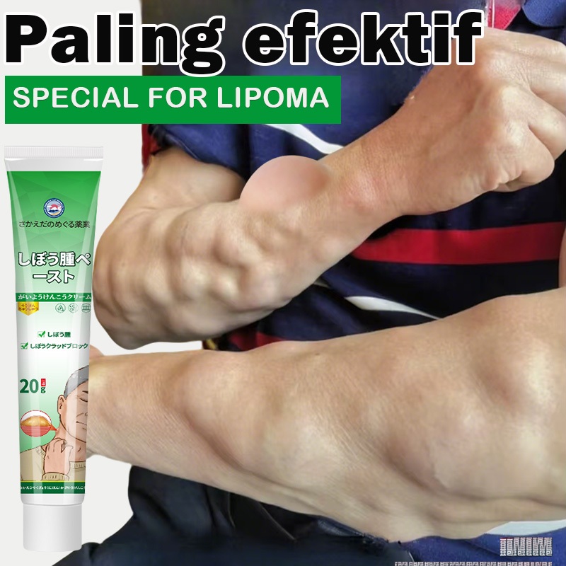 Cream lipoma herbal Obat benjolan lipoma cream original lipoma cream obat lipoma 20g Benjolan tangan