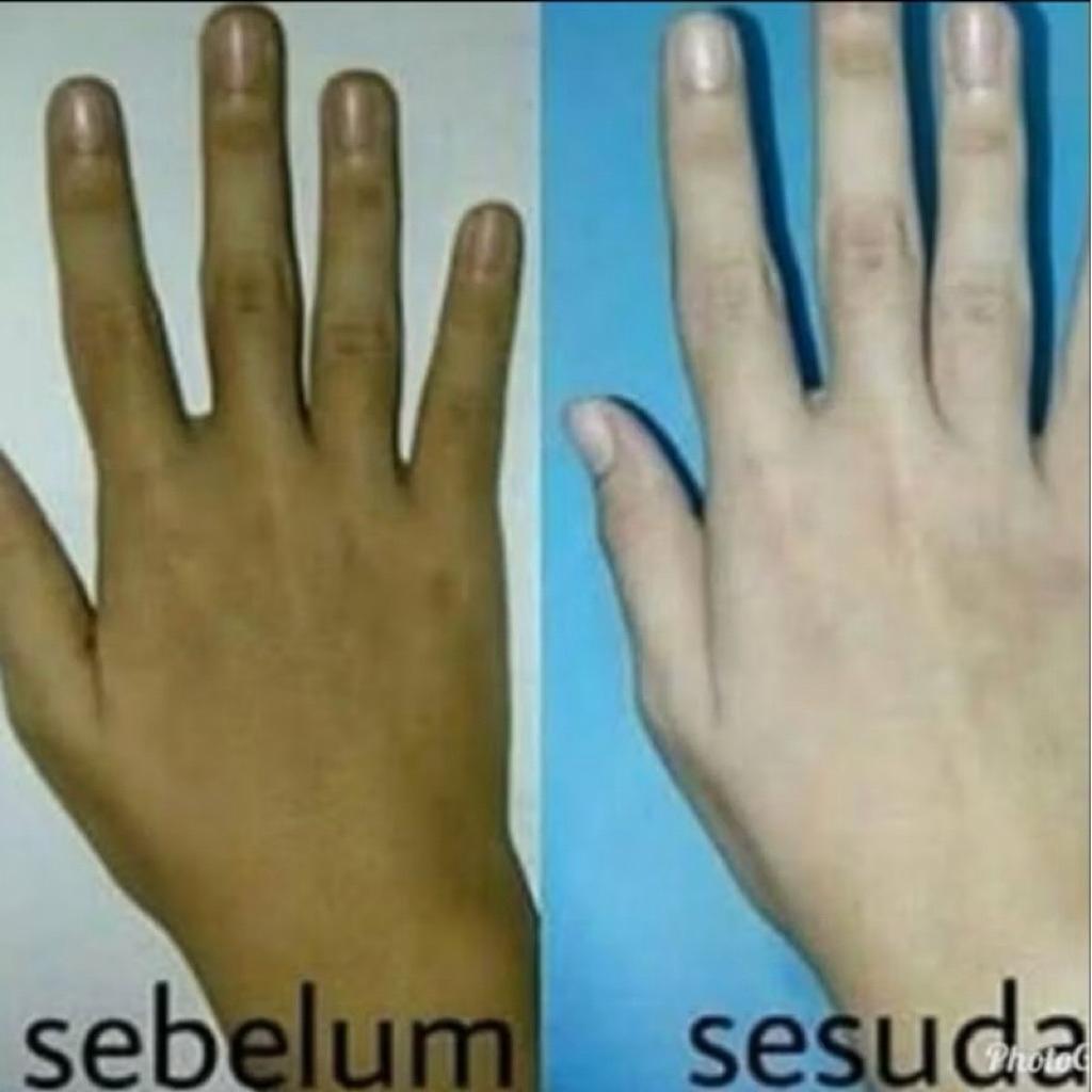 HB CC DOSTING FREE BLEACHING