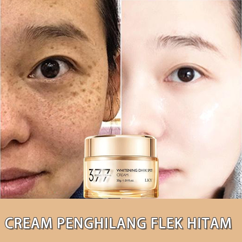 Salep flek hitam membandel pemutih wajah cepat 3 hari bpom marie skin lian cream flek original 30gwa
