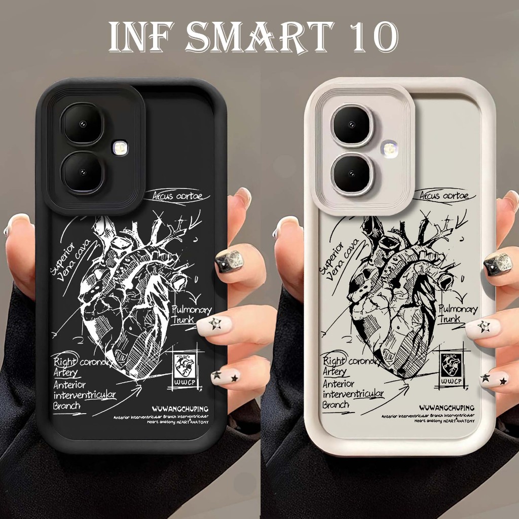 Case Infinix Smart 10 2025 - Casing Hp Infinix Smart 10 - Softcase Infinix Smart 10 - Slikon Infinix