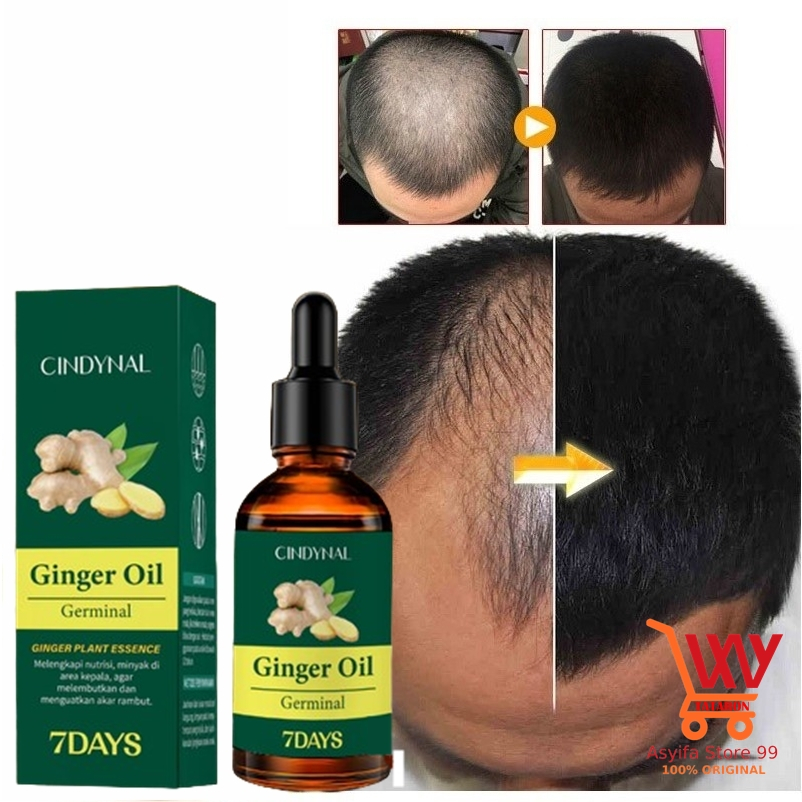Penumbuh Rambut Botak Alami Nutrisi Ori BPOM - Penyubur Rambut Rontok dan Perawatan