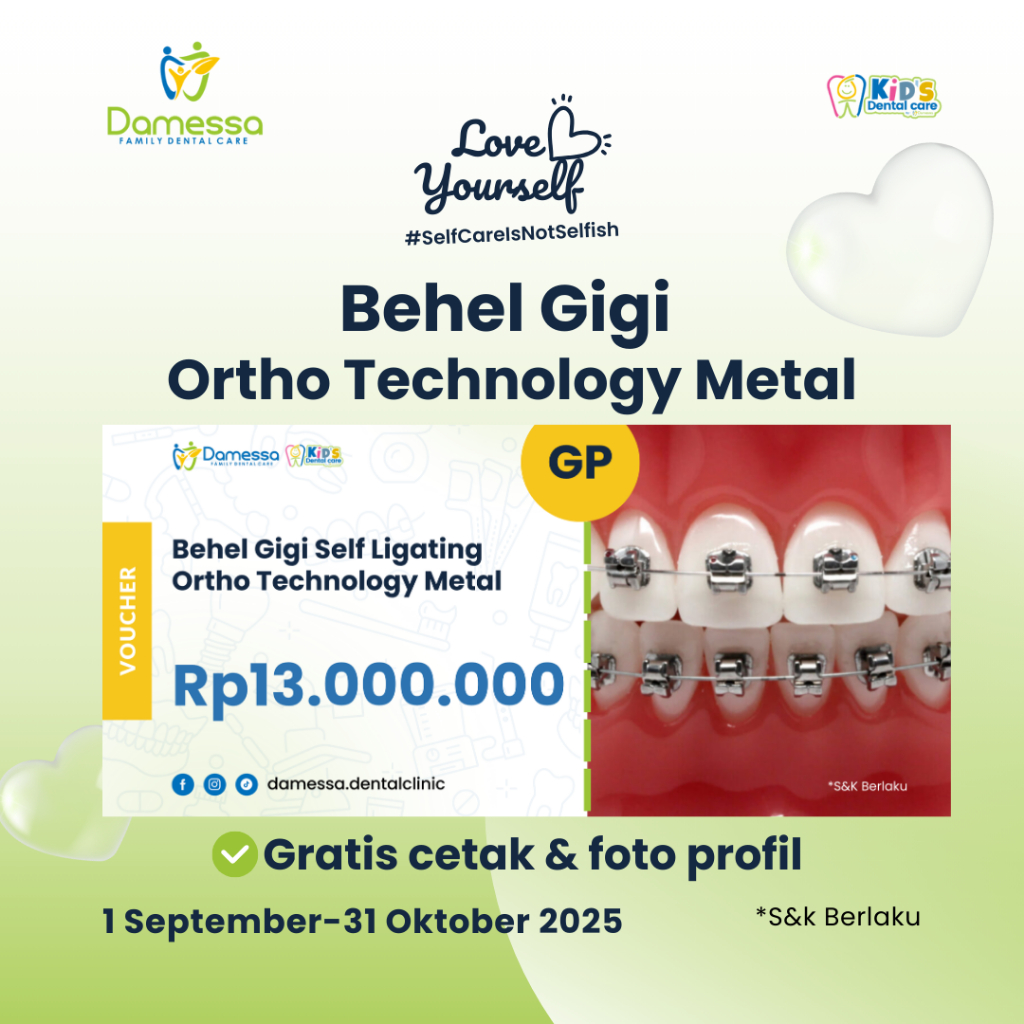 Voucher Behel Gigi Damessa - Pasang Behel Gigi Orthotecnology Metal with General Dentist Dokter Gigi