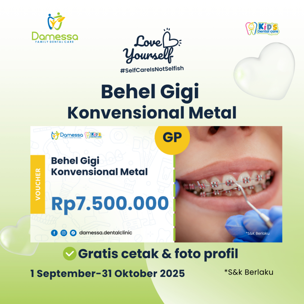 Voucher Behel Gigi Damessa - Pasang Behel Gigi Konvensional Metal with General Dentist