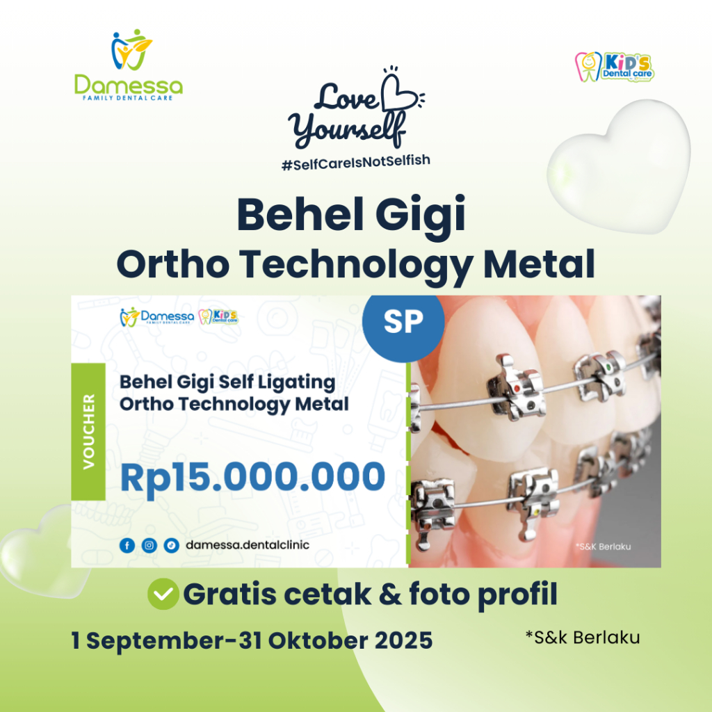 Voucher Behel Gigi Damessa - Pasang Behel Gigi Ortho Technology Metal with Specialist Dentist