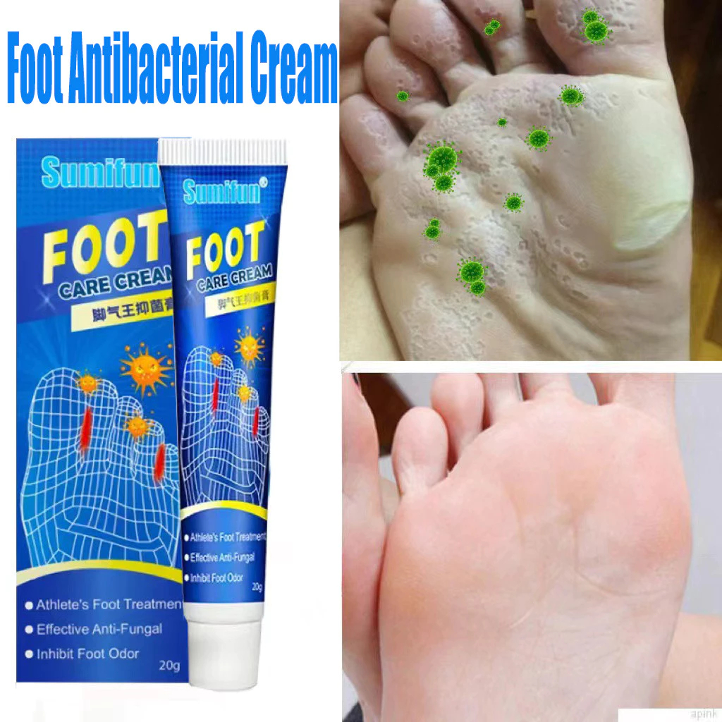 Beriberi Antibacterial Cream Menghilangkan Jamur Tinea Pedis Perawatan Kaki Krim Perawatan Tinea Ped
