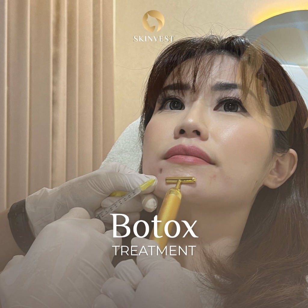 Skinvest Voucher Treatment Botox