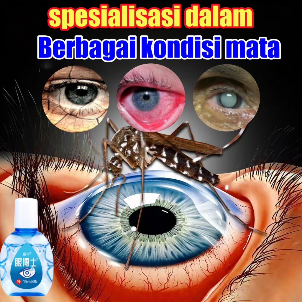 Obat Tetes Mata Obat Mata Katarak Alat Tetes Mata Katarak Obat Mata Merah Pembersih Mata Tetes Mata 