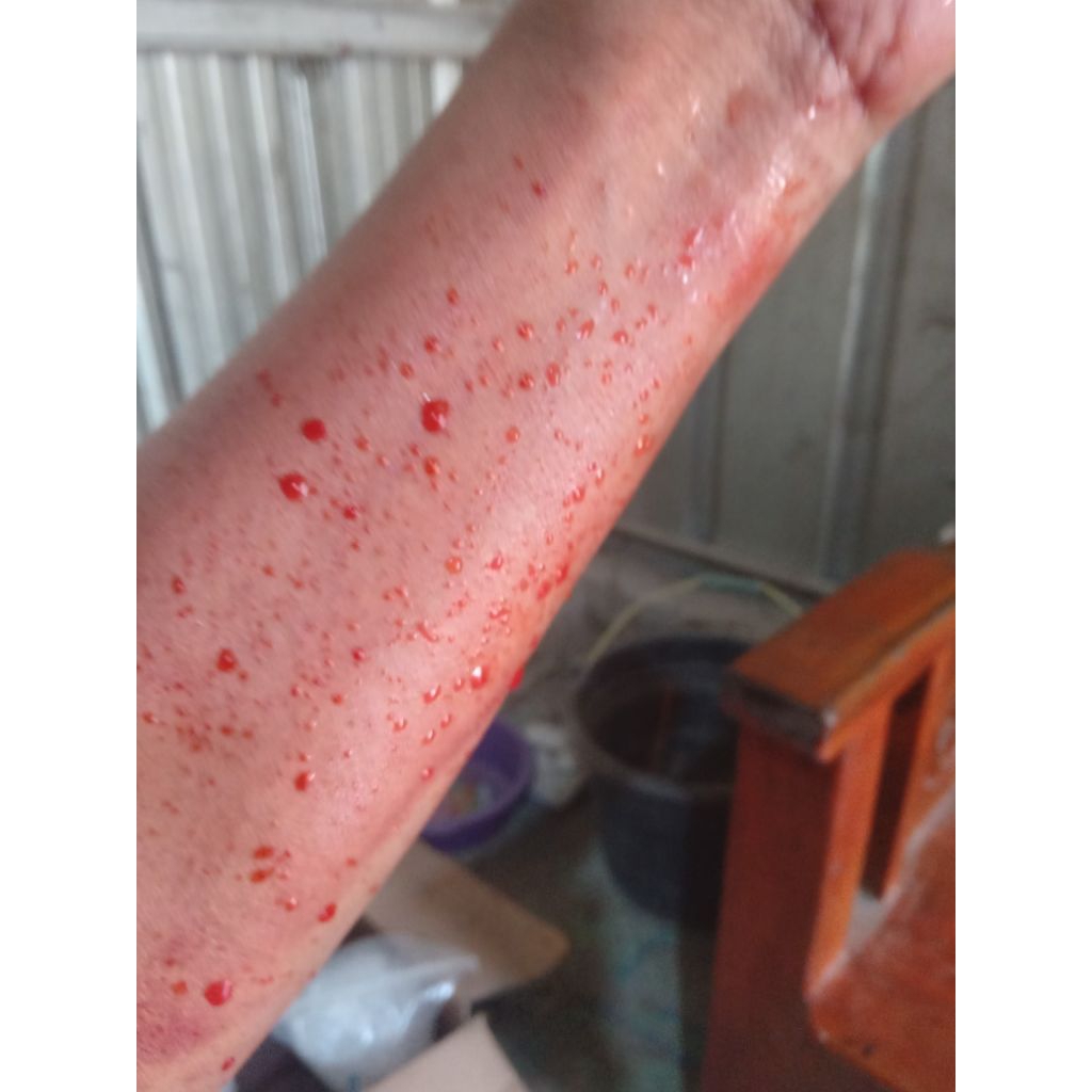 SUPER MURAH  Minyak Sulap (Bisa keluarin Darah Kotor Dari Dalam Tubuh).