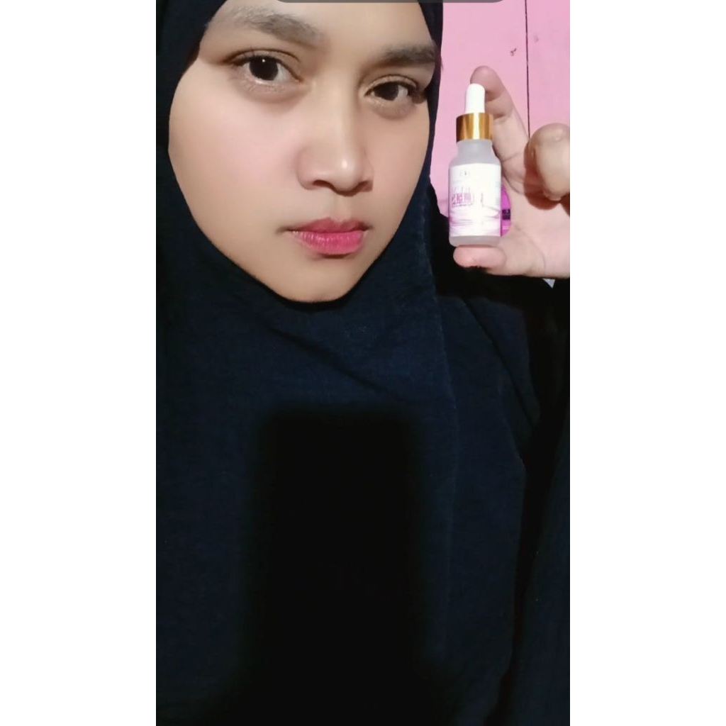 Serum Flek Lumiwhite