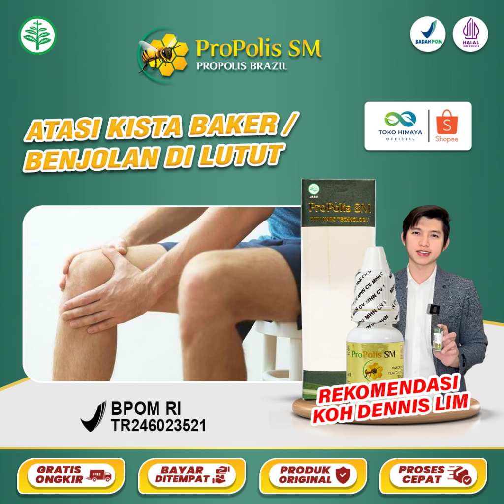 PROPOLIS SM Obat Kista Baker Benjolan Di Belakang Lutut Kanan / Kiri Nyeri Lutut Lutut Bengkak