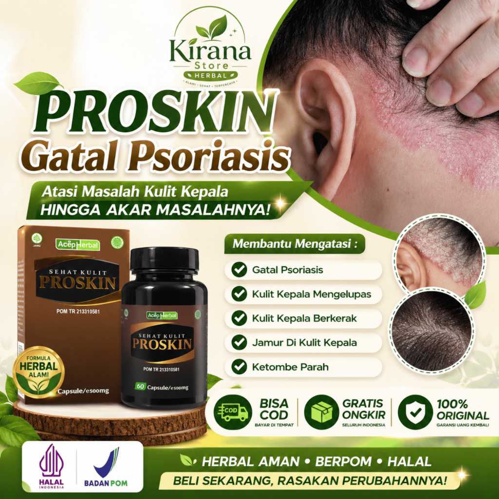 Obat Gatal Psoriasis Kulit Kepala Mengelupas Kulit Kepala Berkerak Jamur Di Kulit Kepala Ketombe par