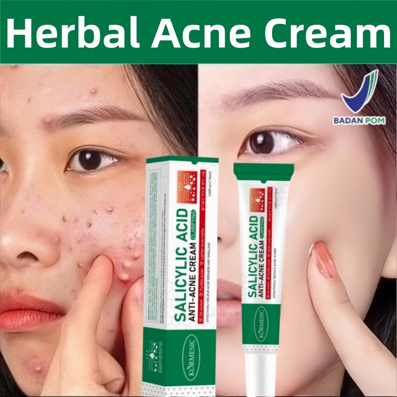 BPOM Herbal Acne Cream Herbal Salep Acnes Penghilang Jerawat dan Bekas Jerawat Obat Totol Jerawat Am