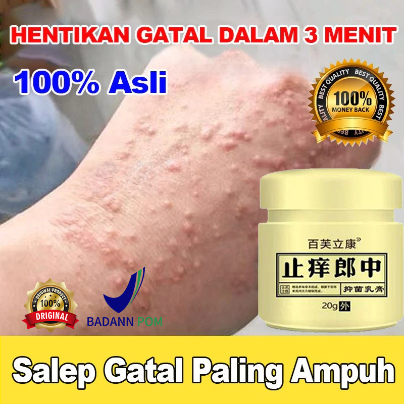 Salep Eksim Kering dan Gatal Salep Gatal Paling Ampuh Obat Gatal Selangkangan Salep Bayi Untuk Kulit