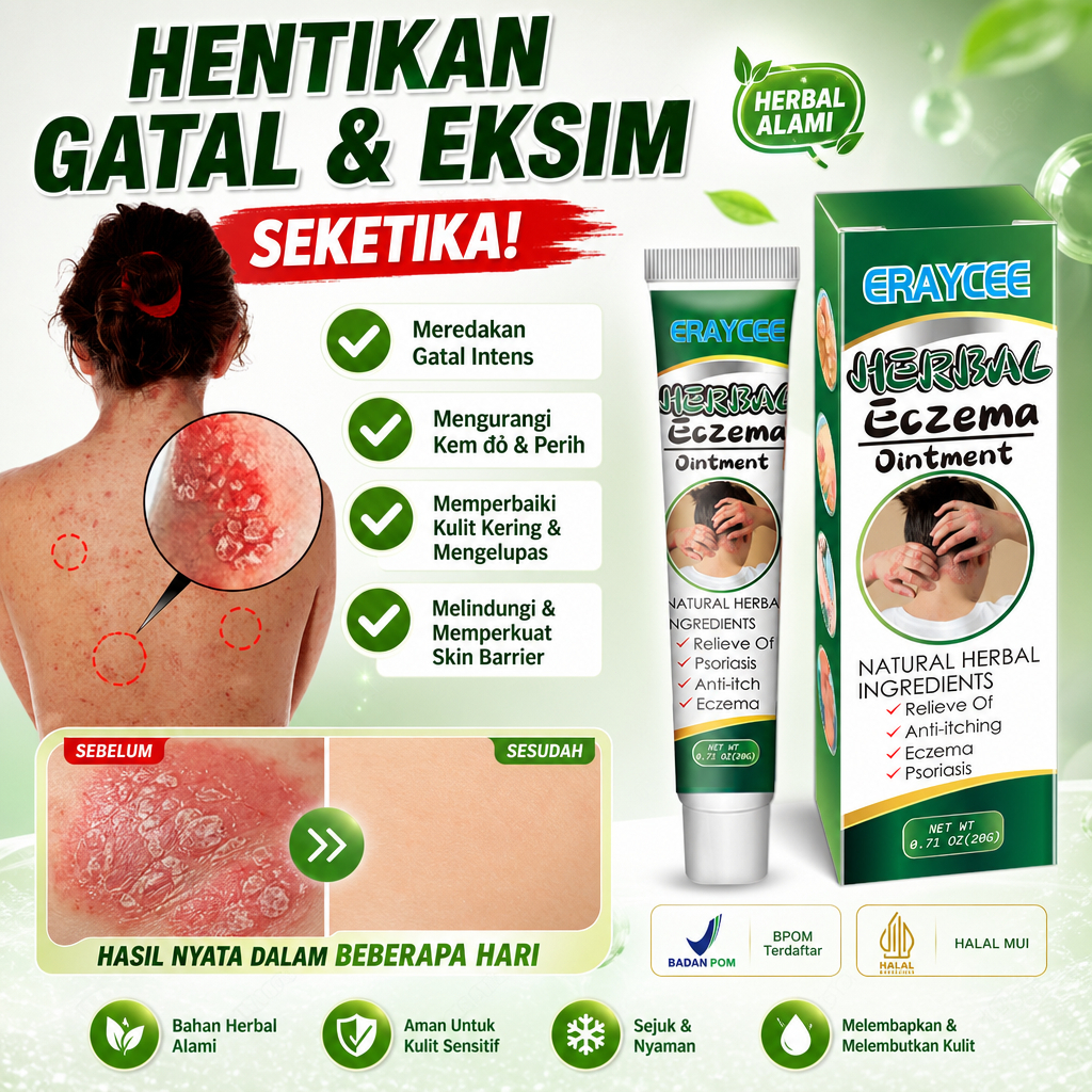 Salep Gatal Herbal 20g Salep Eksim Psoriasis Pereda Gatal Kulit Selangkangan Tangan Kaki Kulit Kepal