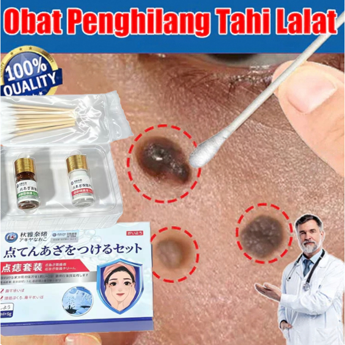 Penghilang Tahi Paket penghilang tahi lalat  Lalat Penghilang Kutil Penghilang Tahi Lalat Di WajahOb